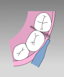 bra_6.jpg(14582 byte)